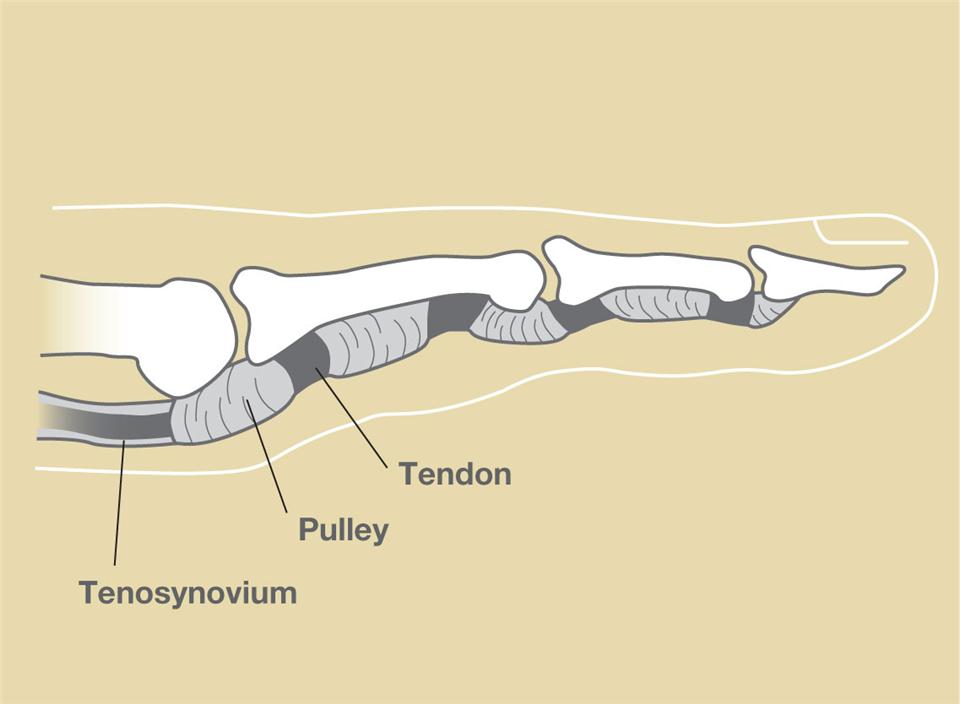 Figure 1:  The pulley and tendon in a finger, gliding normally.